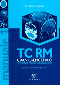 copertina di TC ( Tomografia computerizzata ) - RM ( Risonanza magnetica ) cranio - encefalo - ...