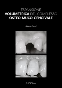 copertina di Espansione volumetrica del complesso osteo - muco - gengivale