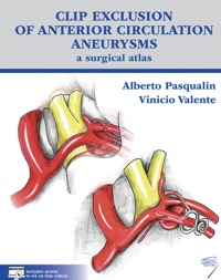 copertina di Clip exclusion of anterior circulation aneurysms: a surgical atlas
