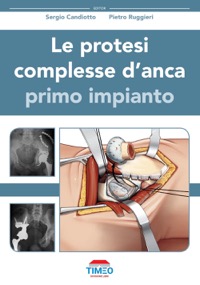 copertina di Le protesi complesse d’ anca - primo impianto