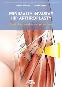 copertina di Minimally invasive hip arthroplasty - Surgical approaches and procedures