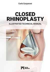 copertina di Closed rhinoplasty . Illustrated technical manual