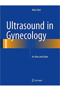 copertina di Ultrasound in Gynecology: Ultrasound in Gynecology