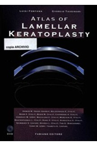 copertina di Atlas of lamellar keratoplasty - Con DVD