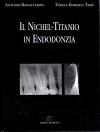 copertina di Il nichel - titanio in endodonzia