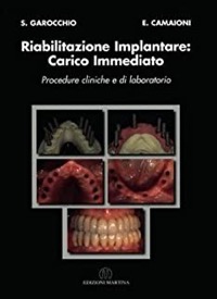 copertina di Riabilitazione implantare : carico immediato - Procedure cliniche e di laboratorio