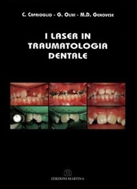 copertina di Il laser in traumatologia dentale