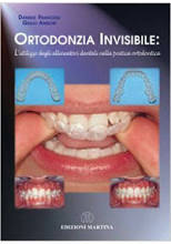 copertina di Ortodonzia invisibile : L' utilizzo degli allineatori dentali nella pratica ortodontica