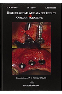 copertina di Rigenerazione guidata dei tessuti e osseointegrazione