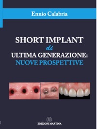 copertina di Short Implant di Ultima Generazione : Nuove Prospettive