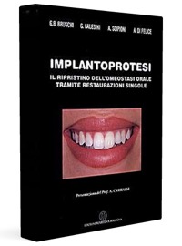 copertina di Implantoprotesi - Il ripristino dell' omeostasi orale tramite restaurazioni singole ...