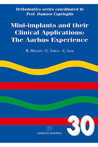 copertina di Mini - implants and their Clinical Applications: the aarhus experience