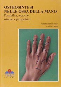 copertina di Osteosintesi nelle ossa della mano - Possibilita', tecniche, risultati e prospettive