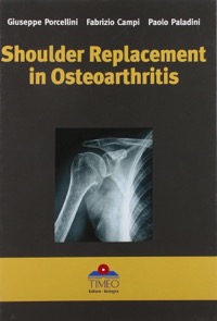 copertina di Shoulder replacement in osteoarthritis