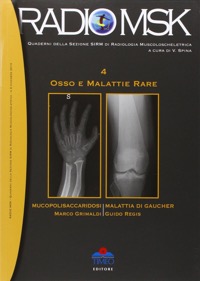 copertina di Osso e malattie rare - Mucopolisaccaridosi, Malattia di Gaucher - Volume 4 - Collana ...