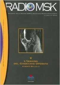 copertina di L' imaging del ginocchio operato - Volume 6 - Collana Radio MSK