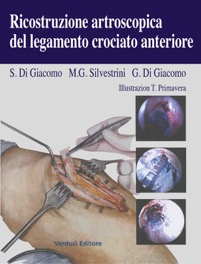 copertina di Ricostruzione artroscopica del legamento crociato anteriore