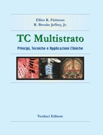 copertina di TC ( Tomografia Computerizzata ) Multistrato - Principi, tecniche e applicazioni ...