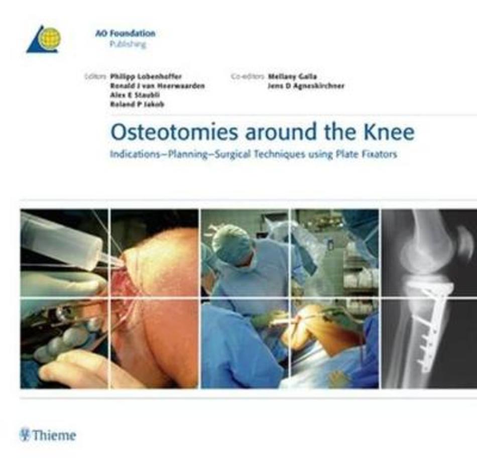 Lobenhoffer AAVV Osteotomies around the Knee Indication Planning
